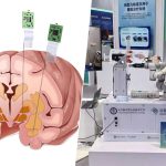 China no quiere quedarse atrás en la carrera por los implantes de cerebro: Neuroscroll es su respuesta a Neuralink